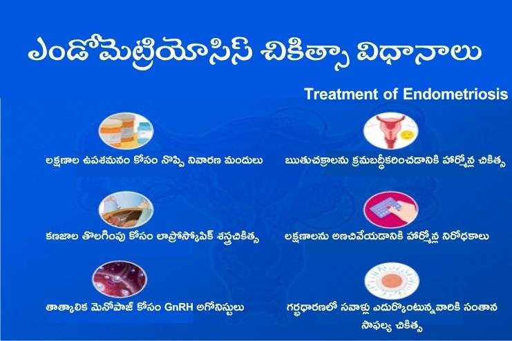 Treatment of endometriosis