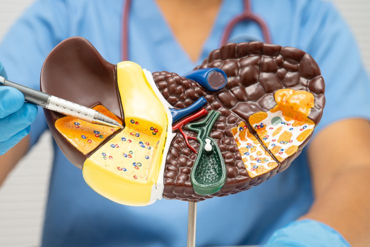 What is MASLD liver disease