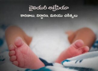 బైలియరీ అట్రేసియా: కారణాలు, నిర్ధారణ, మరియు చికిత్సలు Biliary atresia_ Symptoms, Causes, and Treatments
