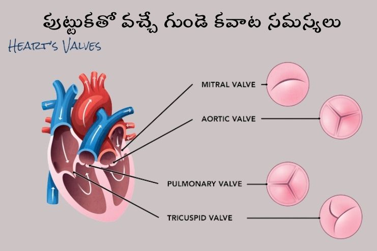 Changes in the connections in the heart