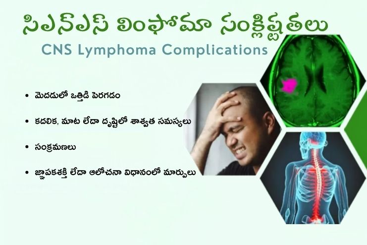 Complications of Brain Aneurysms