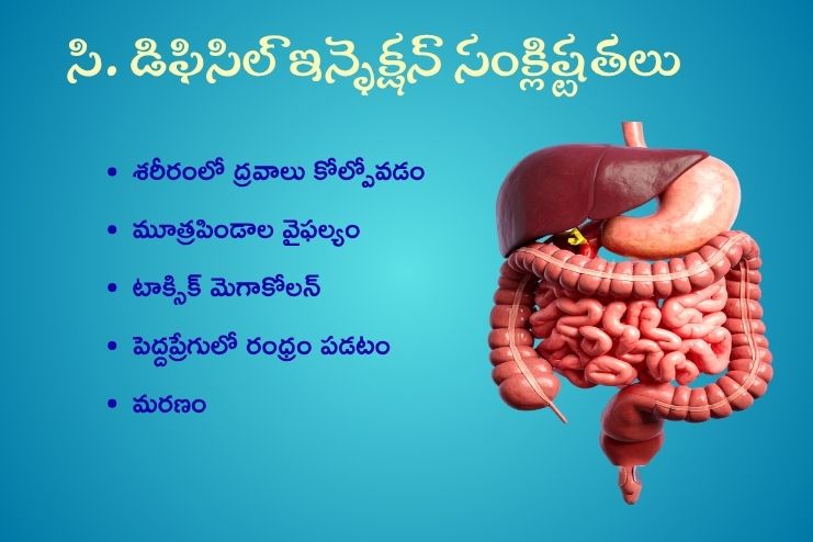 Complications of C. diff infection