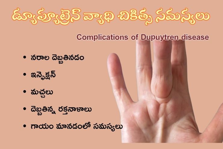 Complications of Dupuytren disease