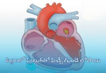 పిల్లలలో పుట్టుకతో వచ్చే గుండె లోపాలు: కారణాలు, నిర్ధారణ, చికిత్స Congenital heart defects in children_ Causes, and Treatments