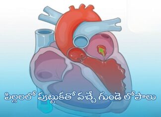 పిల్లలలో పుట్టుకతో వచ్చే గుండె లోపాలు: కారణాలు, నిర్ధారణ, చికిత్స Congenital heart defects in children_ Causes, and Treatments