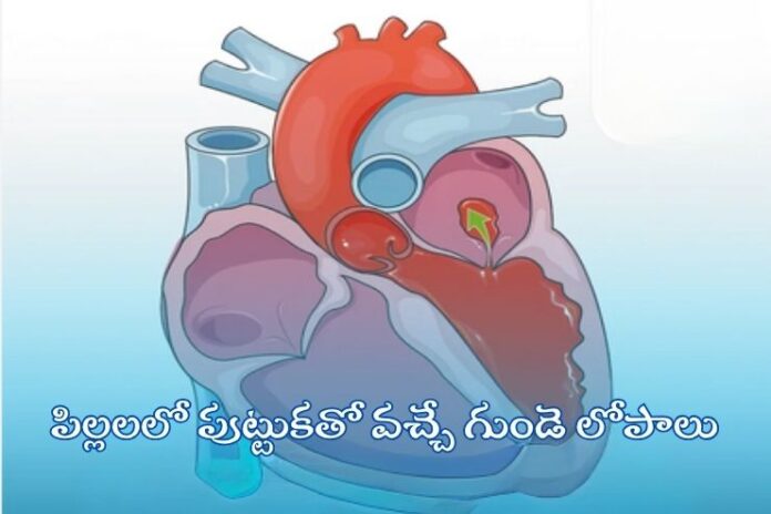 Congenital heart defects in children_ Causes, and Treatments