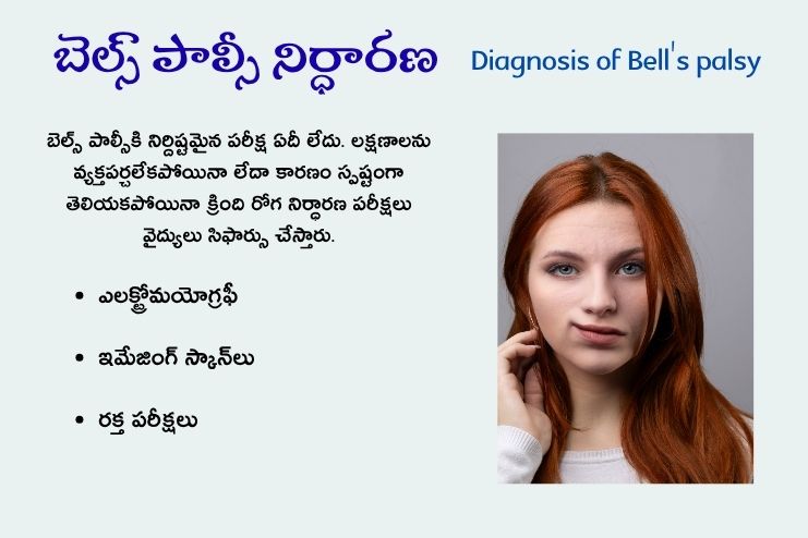 Diagnosis of Bell's palsy