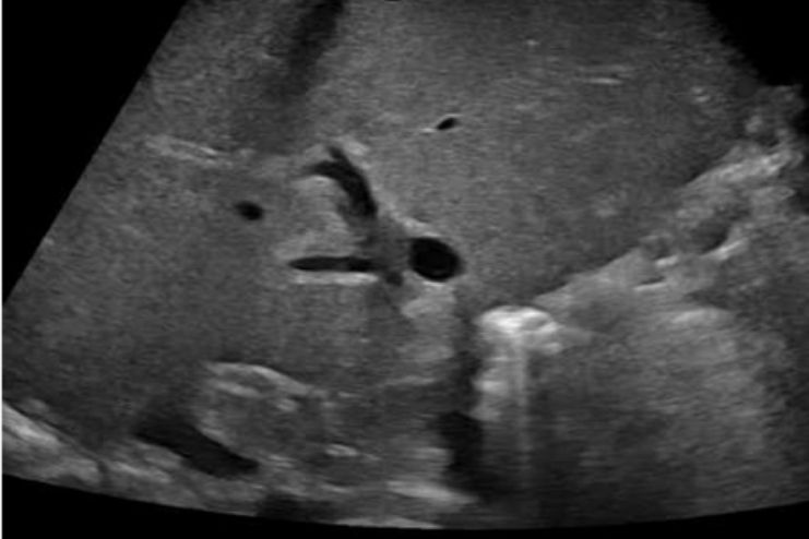 Imaging tests-ultra sound