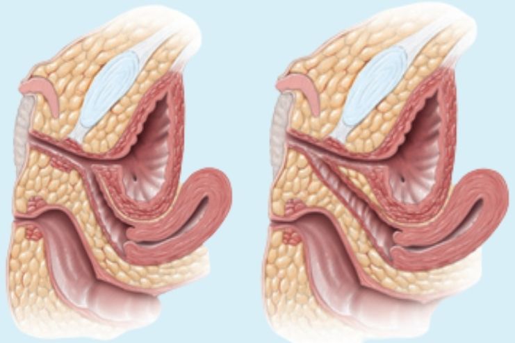 Reconstructive surgery