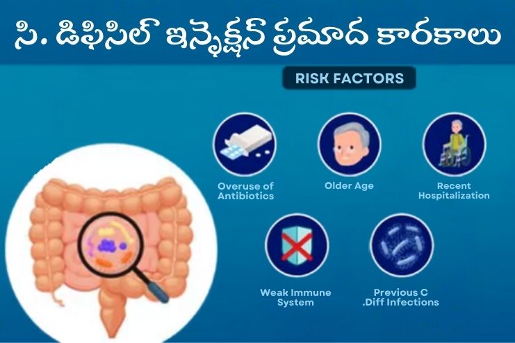 Risk factors