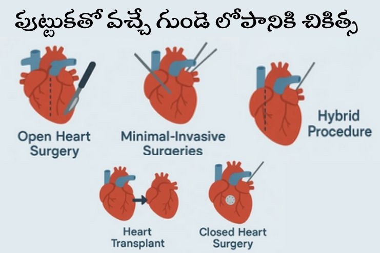 Surgery or other procedures