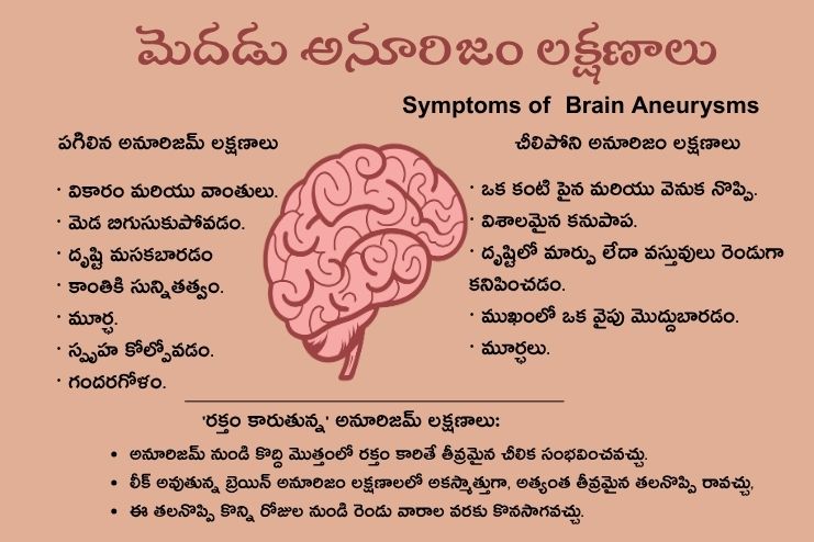 Symptoms of Brain Aneurysms