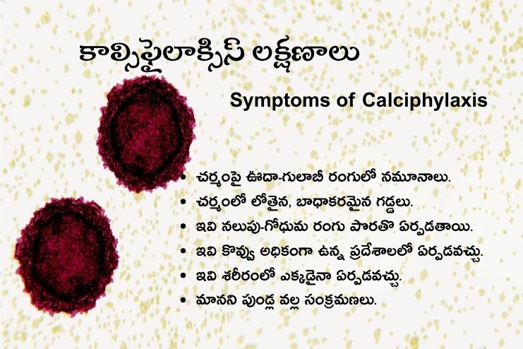 Symptoms of Calciphylaxis
