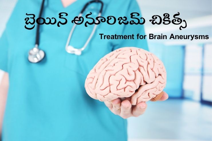 Treatment for Brain Aneurysms