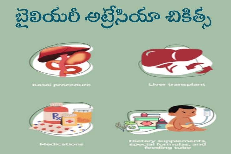 Treatment for biliary atresia