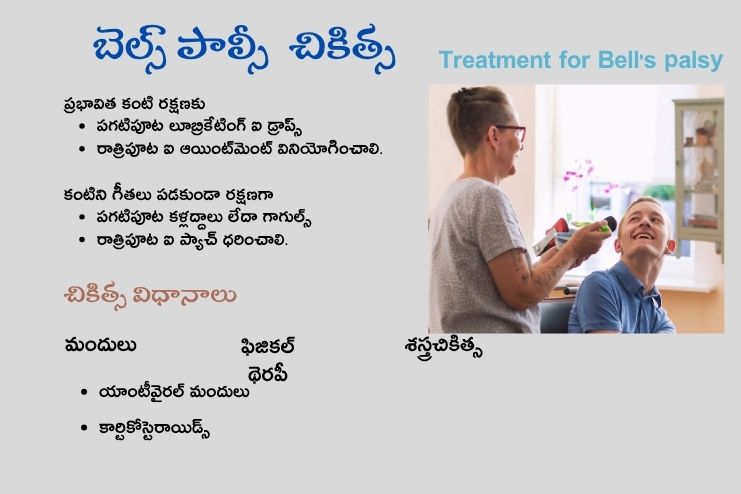 Treats for Bell's palsy