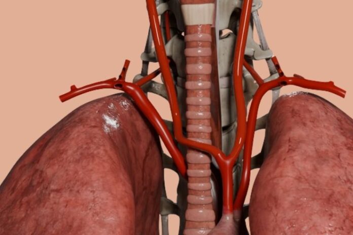 What Is an Aberrant Right Subclavian Artery What Is an Aberrant Right Subclavian Artery