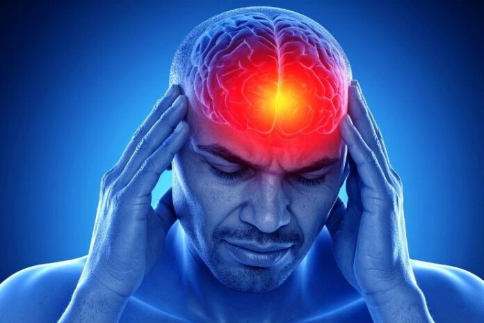 what is Concussion what is Concussion