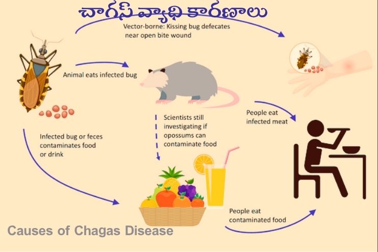 Causes of Chagas Disease