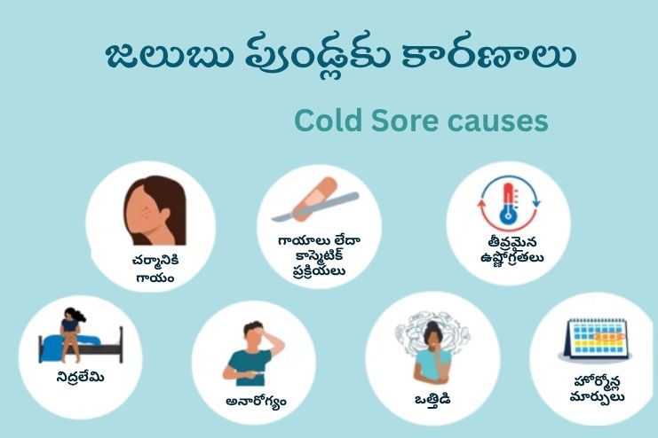 Causes of Cold sores