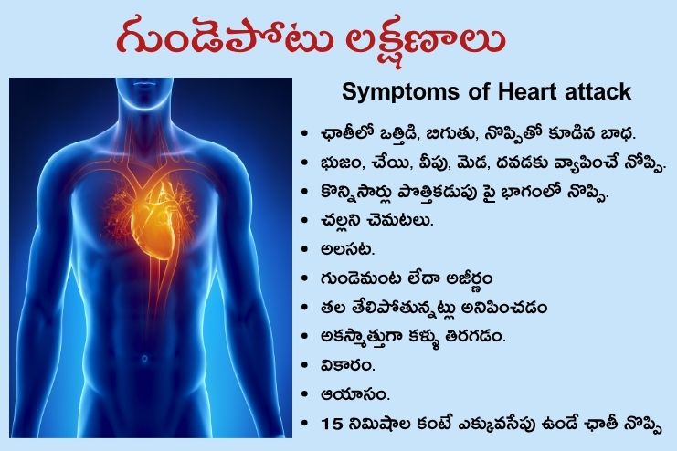 symptoms of cardiogenic shock