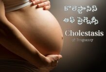 కొలెస్టాసిస్ ఆఫ్ ప్రెగ్నెన్సీ: నిర్ధారణ మరియు చికిత్స Cholestasis of Pregnancy symptoms diagnosis and treatment