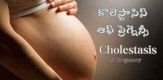 కొలెస్టాసిస్ ఆఫ్ ప్రెగ్నెన్సీ: నిర్ధారణ మరియు చికిత్స Cholestasis of Pregnancy symptoms diagnosis and treatment