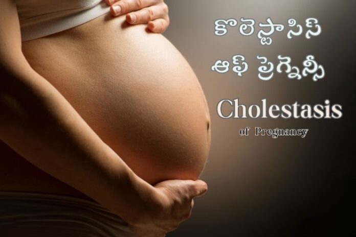Cholestasis of Pregnancy symptoms diagnosis and treatment