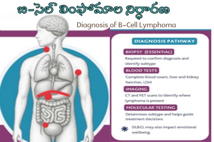 Diagnosis of B-Cell Lymphoma