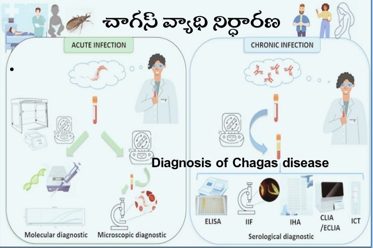 Diagnosis of Chagas disease