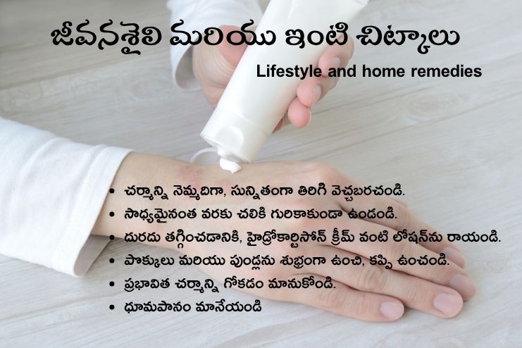Lifestyle and home remedies