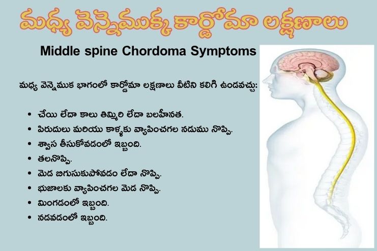 Middle spine Chordoma Symptoms