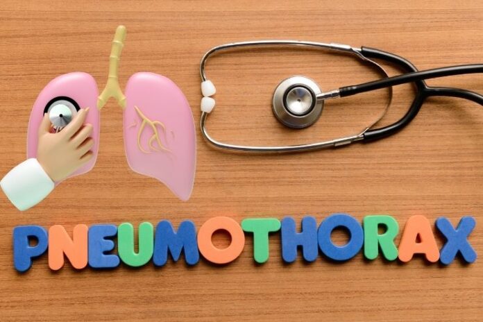 Pneumothorax_ Causes, Symptoms, and Treatments Pneumothorax_ Causes, Symptoms, and Treatments