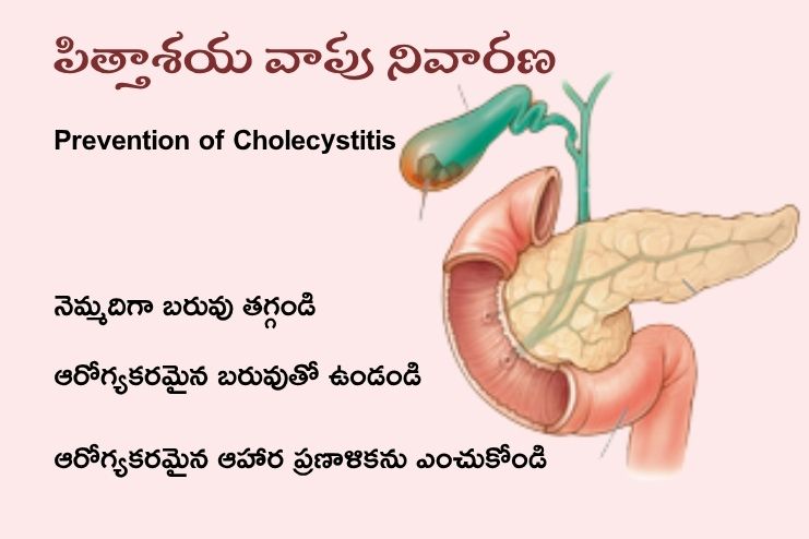 Prevention of Cholecystitis