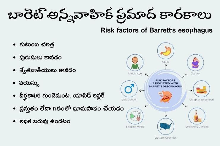 Risk factors of Barrett's esophagus