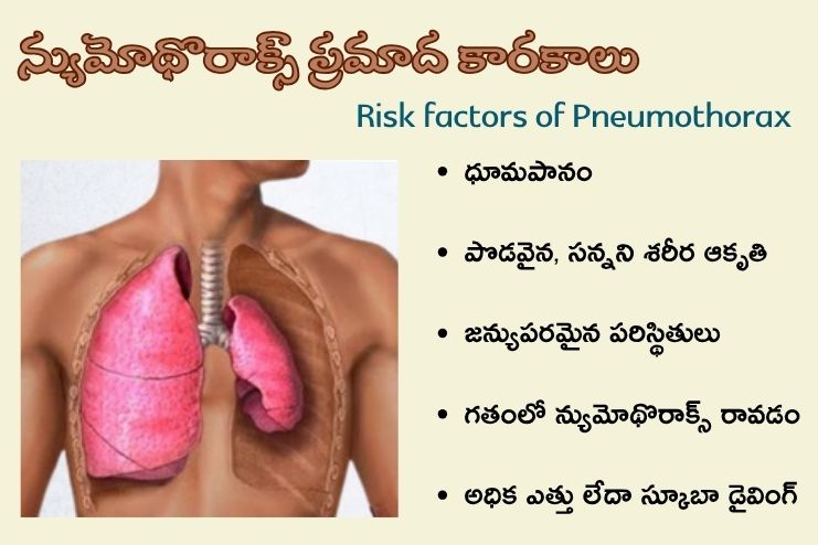 Risk factors of Pneumothorax