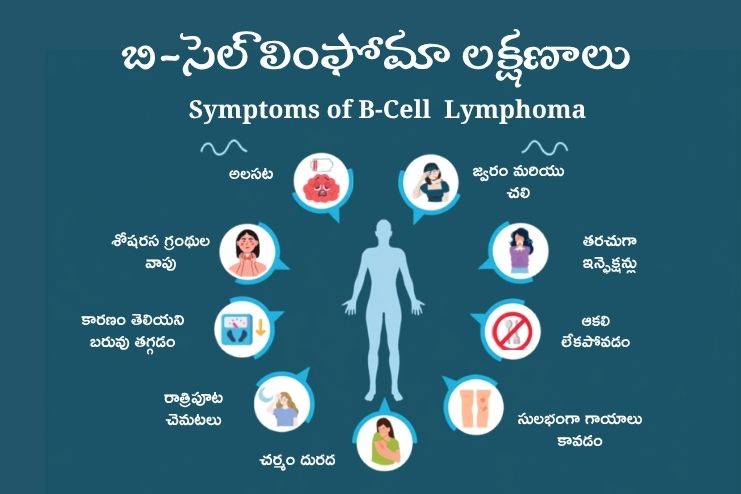 Symptoms of B-Cell Lymphoma