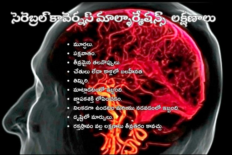 Symptoms of CCM