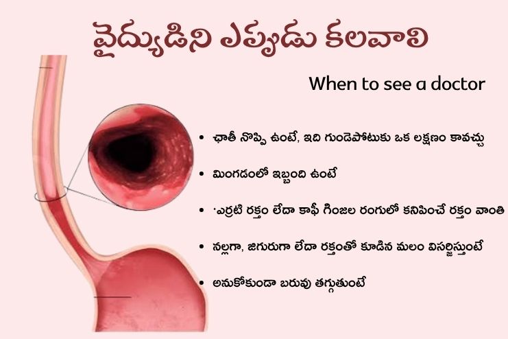 When to see a doctor