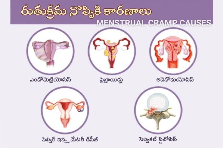 menstrual cramp causes