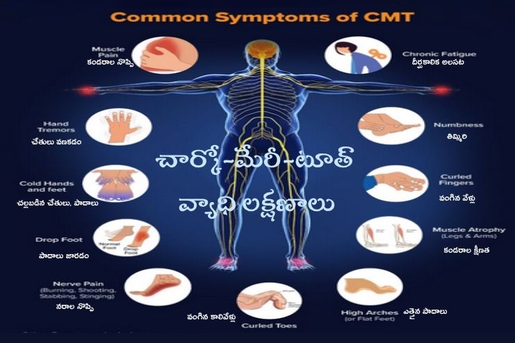 symptoms of CMT
