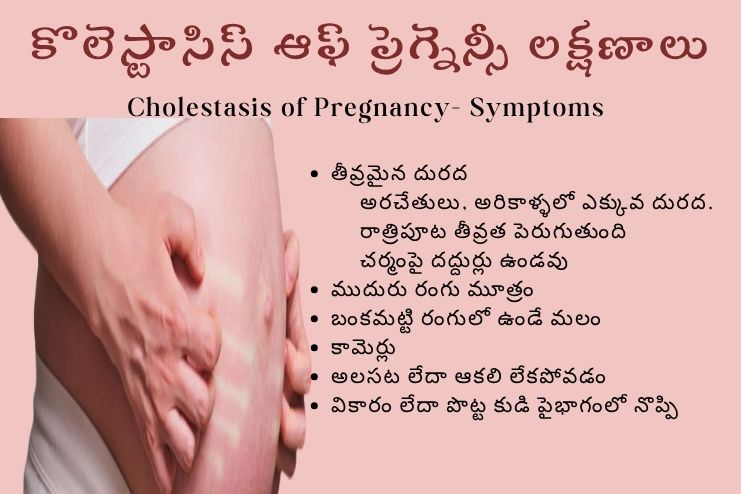 symptoms of Cholestasis of Pregnancy