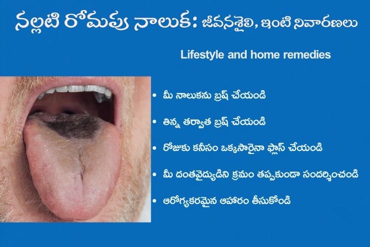 Black Haired Tongue-Lifestyle and home remedies
