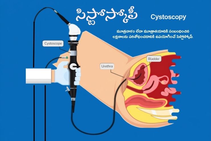 Diagnosis Cystoscopy