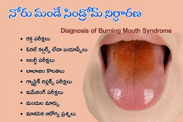 Diagnosis of Burning Mouth Syndrome