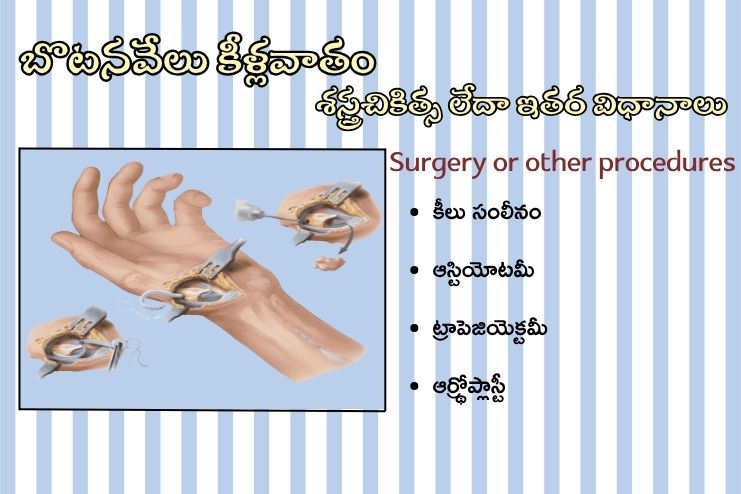 Surgery for Bardet-Biedl syndrome