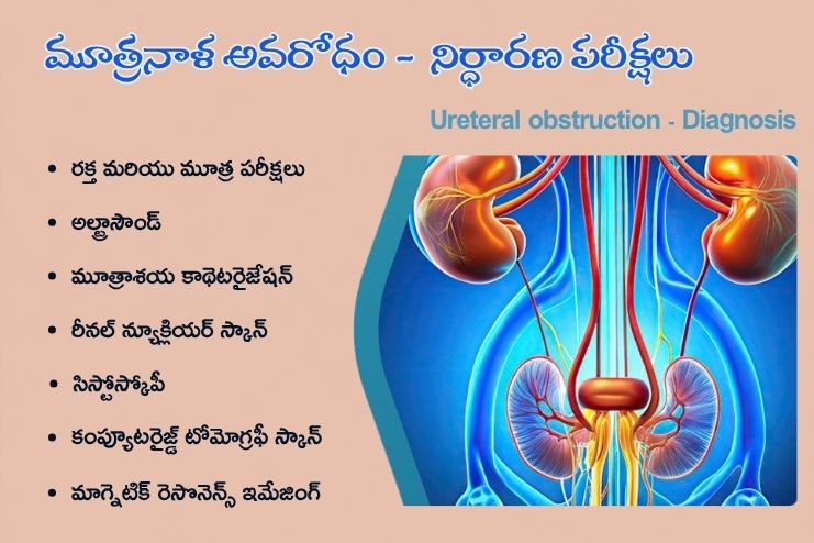 Ureteral obstruction - Diagnosis