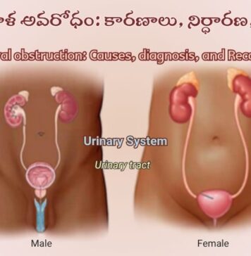 మూత్రనాళ అవరోధం: కారణాలు, లక్షణాలు, చికిత్స Ureteral obstruction_ Causes, diagnosis, and Recovery