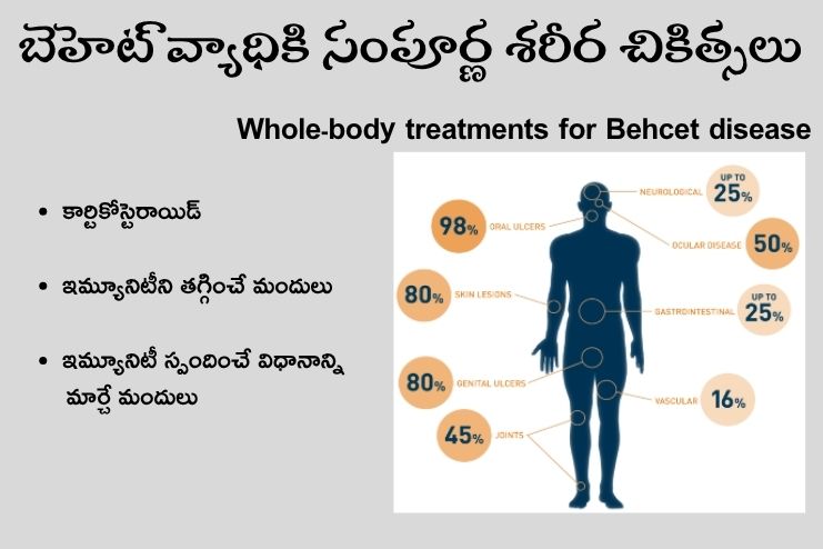 Whole-body treatments for Behcet disease